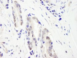 CHD3 Antibody, Novus Biologicals 0.1mL; Unlabeled:Antibodies, Polyclonal